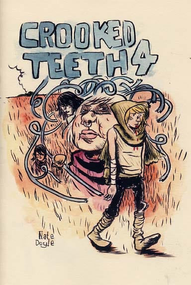 Crooked Teeth #4