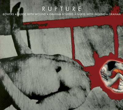 Rupture |