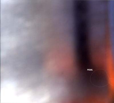 Pedal |