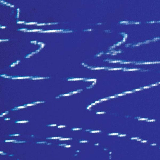 Information Pollution |